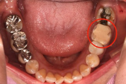 Case01 治療前の写真