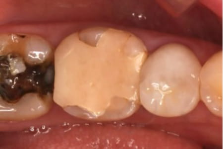 Case01 治療前のアップ写真