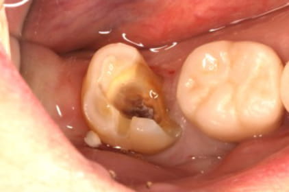 Case02 治療前の写真